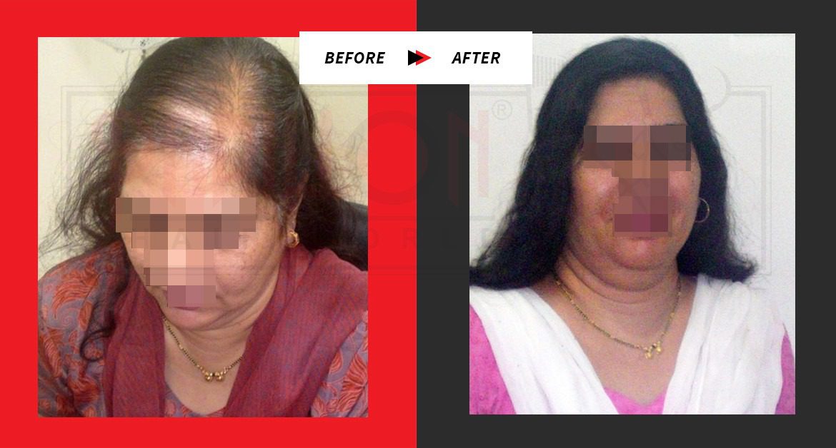 Neeta Kulkarni