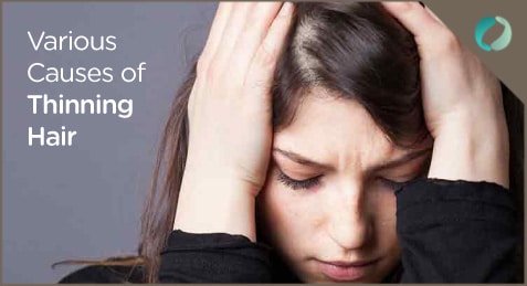 The Common Causes of Hair Loss in Women!
