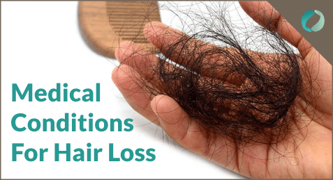 Medical Reasons For Hair Loss