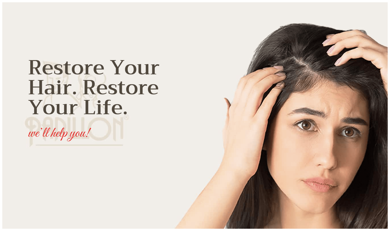 Female Pattern Baldness Female Pattern Baldness